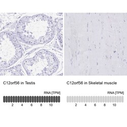 C12orf56 Antibody, Novus Biologicals 0.1mL; Unlabeled:Antibodies, Polyclonal